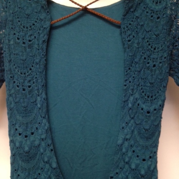 NIGHTCAP Lace Priscilla Open Back Dress EUC - Picture 11 of 12